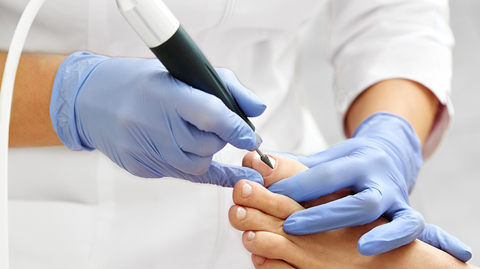 Schönheitspfleger: „Kein weiterer Tag mit geschlossenen Türen möglich!“ Podologe bearbeitet Fußnagel mit elektrischem Werkzeug