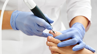 News Podologe bearbeitet Fußnagel mit elektrischem Werkzeug