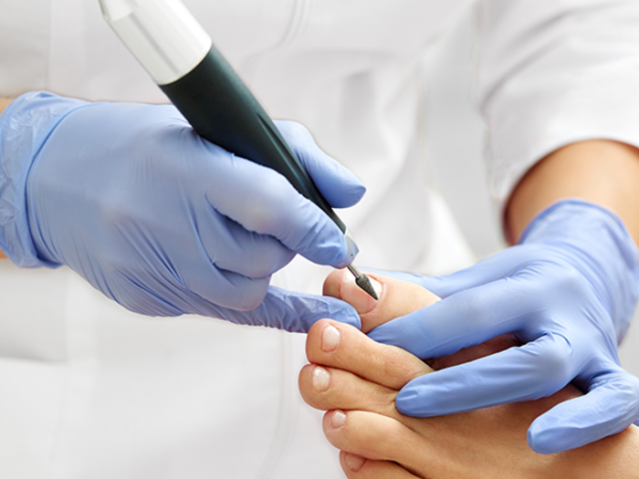 Schönheitspfleger: „Kein weiterer Tag mit geschlossenen Türen möglich!“ Podologe bearbeitet Fußnagel mit elektrischem Werkzeug